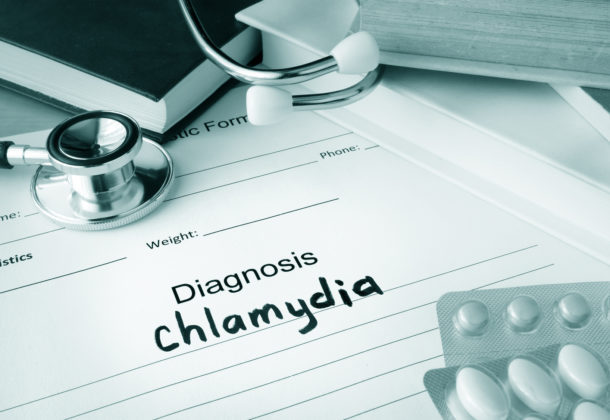 Diagnostic form with diagnosis chlamydia and pills.